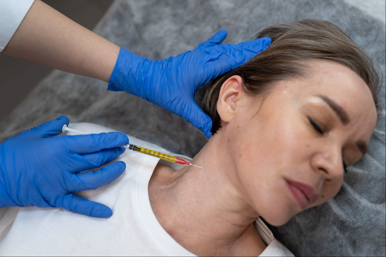 O inchaço pode ser um efeito colateral do botox 